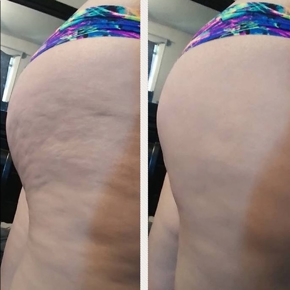 Anti-cellulite Firming Cream Body Boost - Picture 4 of 7